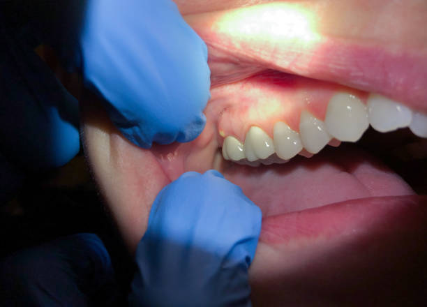 Best Broken Tooth Emergency  in North Ridgeville, OH