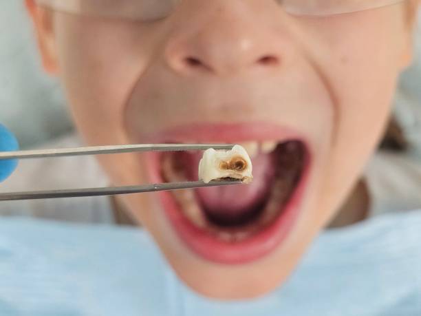 Best Cracked Tooth Emergency Dentist  in North Ridgeville, OH
